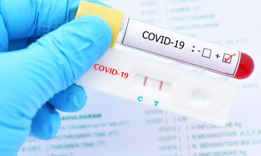 28 federal lawmakers tested positive for Covid-19